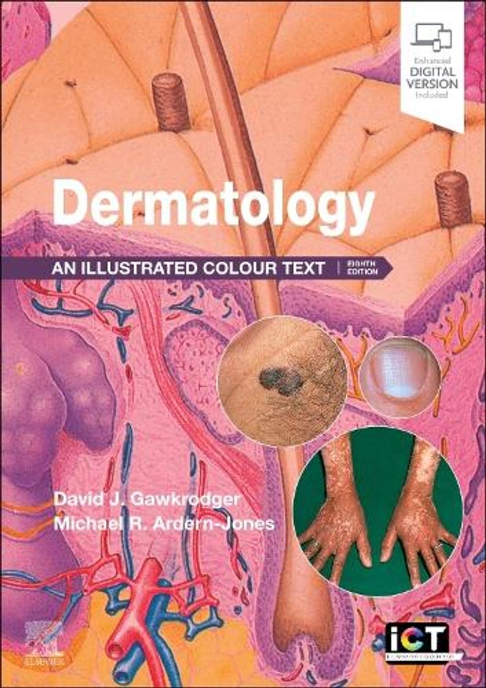 Dermatology: An Illustrated Colour Text by David Gawkrodger Paperback Book