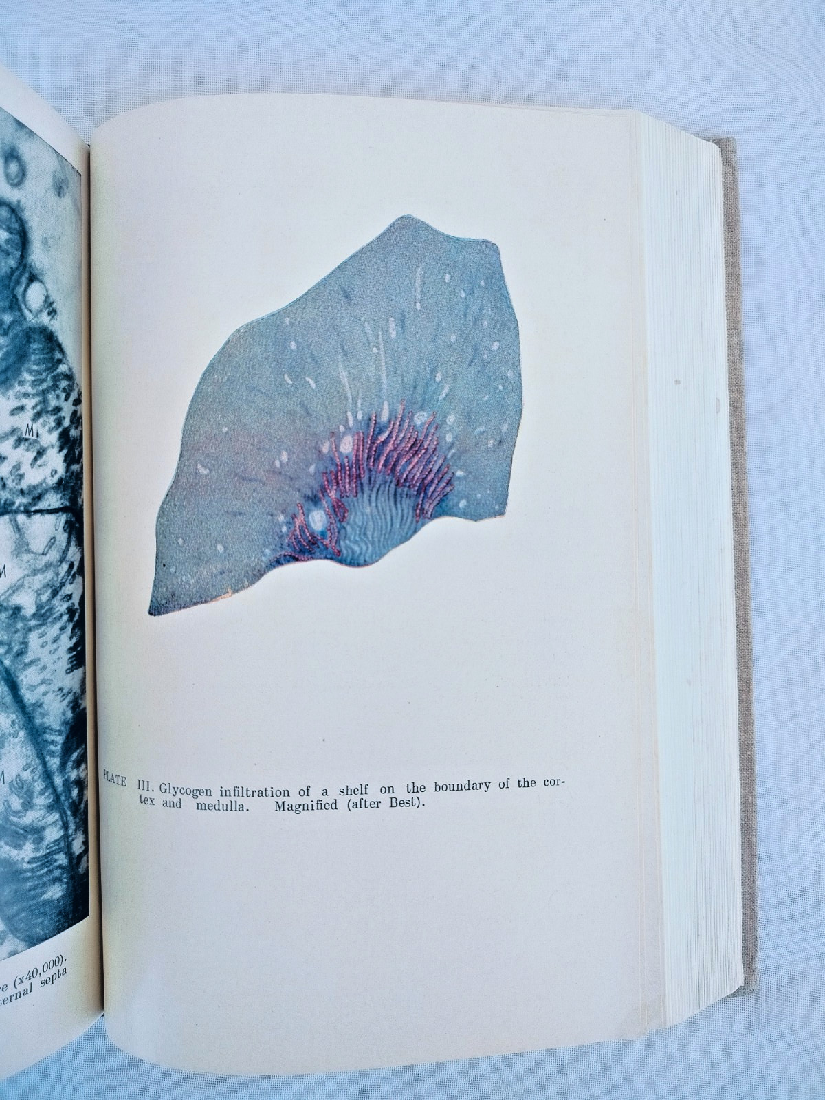 General Human Pathology by Ippolit Davydovsky, Mir Publishers, 1971, Hardcover
