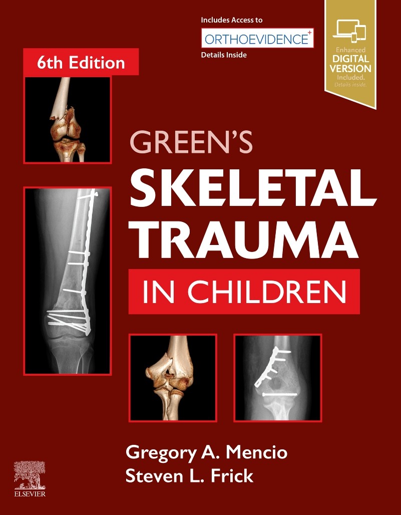 Green’s Skeletal Trauma in Children