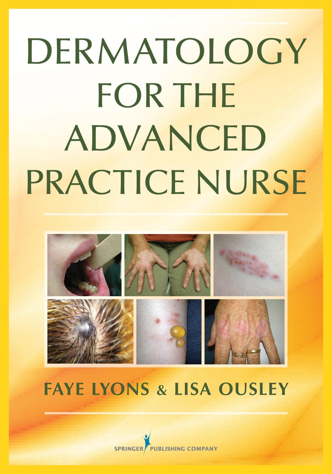Dermatology for the Advanced Practice Nurse by Faye Lyons DNP RN FNP-C