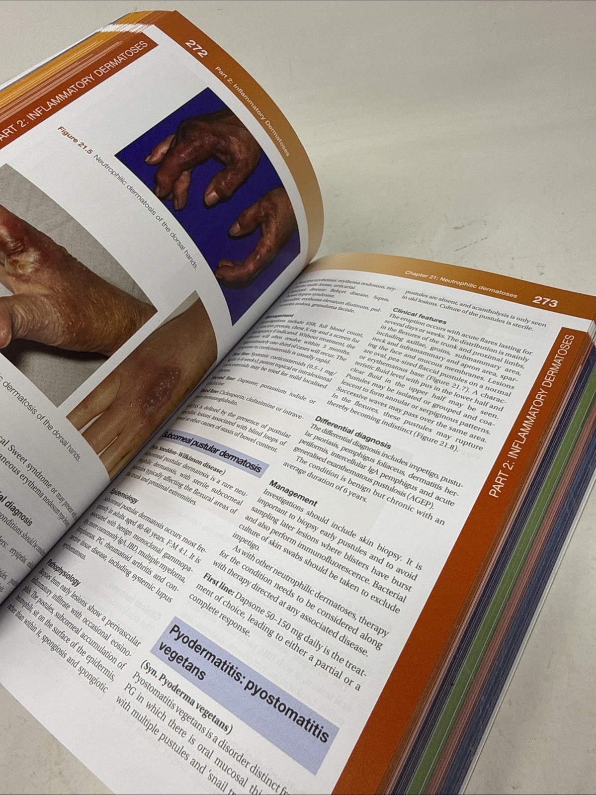 Rook’s Dermatology Handbook (Paperback) (UK IMPORT)