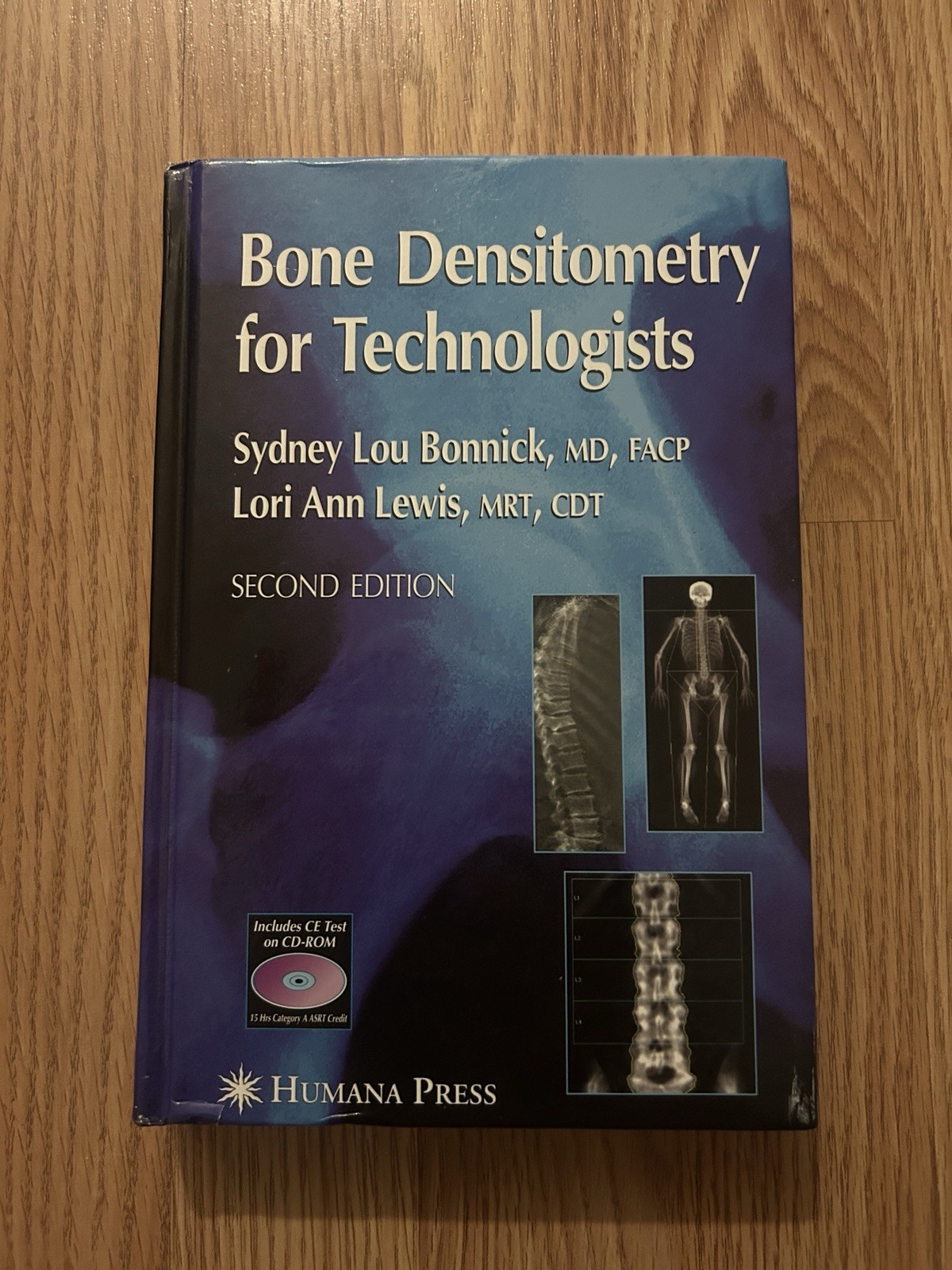 Bone Densitometry for Technologists by Lori Ann Lewis & Sydney Lou Bonnick 2006