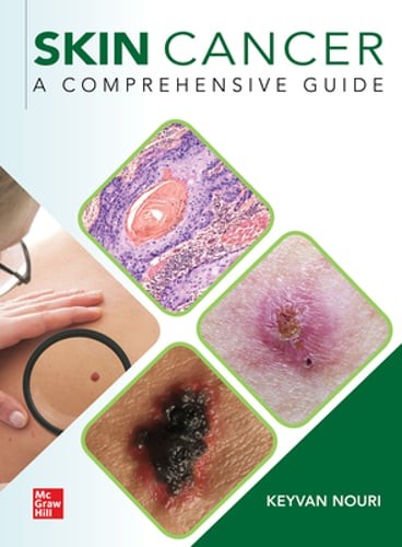 Skin Cancer: A Comprehensive Guide by Keyvan Nouri: Used
