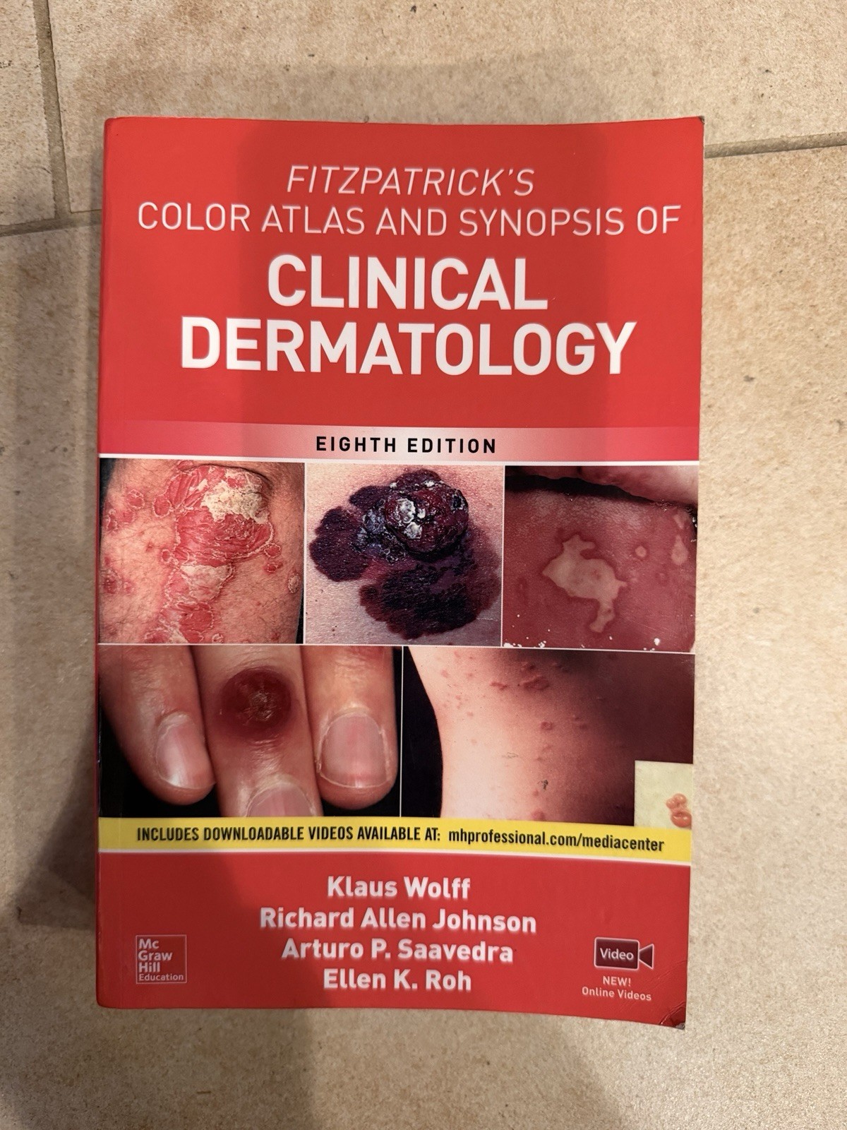 Fitzpatrick’s Color Atlas AND SYNOPSIS OF CLINICAL DERMATOLOGY 8th Edition