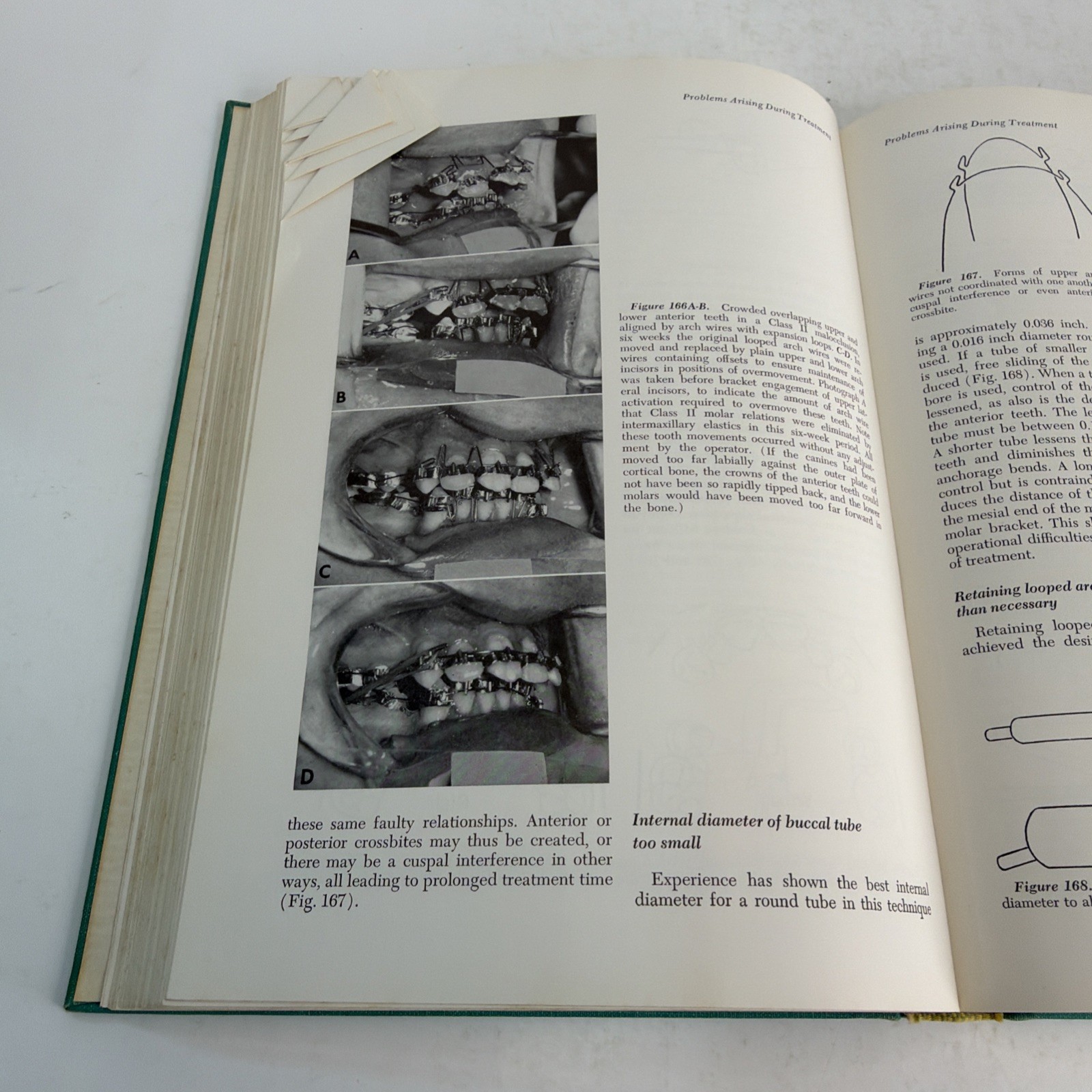 Begg Orthodontic Theory and Technique 1965 Hardcover by P. R. Begg