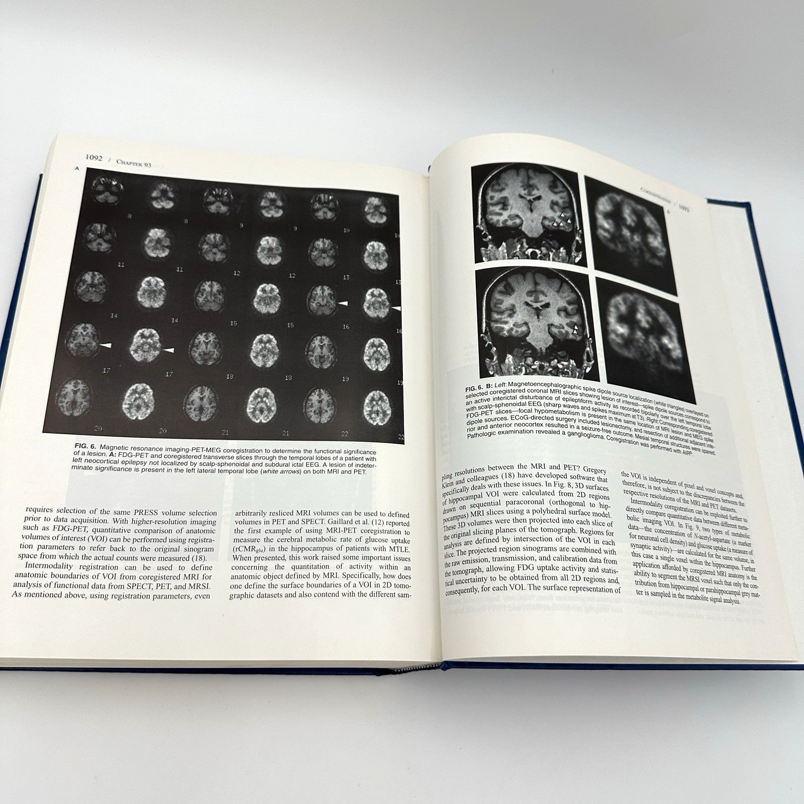 Epilepsy Comprehensive Textbook Vol 1 Engel Pedley 1st Edition ISBN 03975163 HC