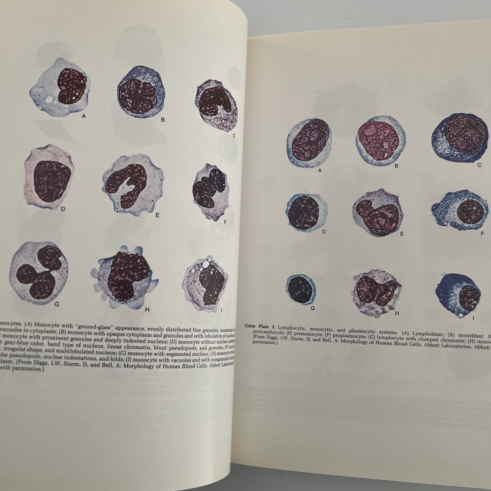Clinical Hematology and Fundamentals of Hemostasis Hardcover SH