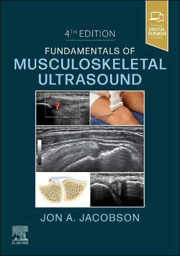 Jon A. Jacobson Fundamentals of Musculoskeletal Ultrasou (Paperback) (UK IMPORT)