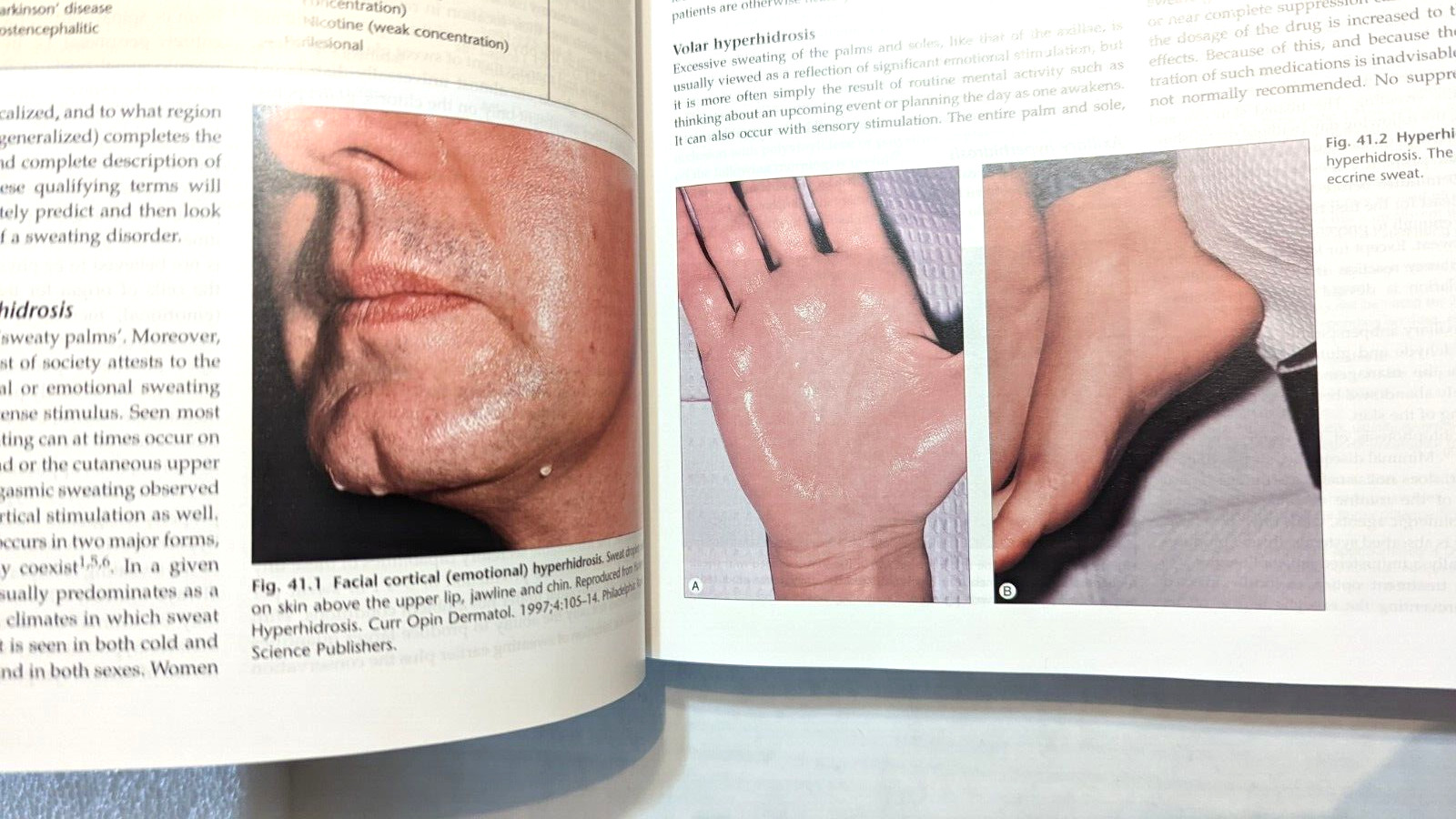 Dermatology Medical Text – 2 Volume Set, Jean Bologinia 2003