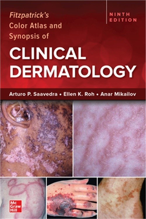 Fitzpatrick’s Color Atlas and Synopsis of Clinical Dermatology, Ninth Edition (P