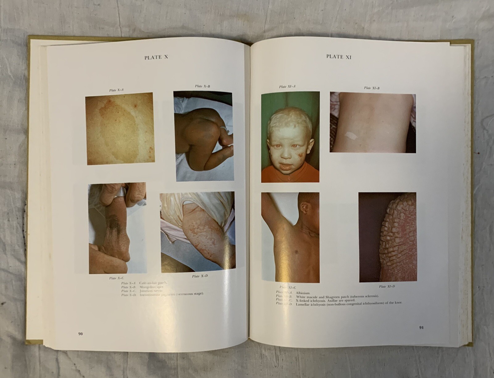 NEONATAL DERMATOLOGY, MAJOR PROBLEMS IN CLINICAL PEDIATRICS by Solomon & Esterly