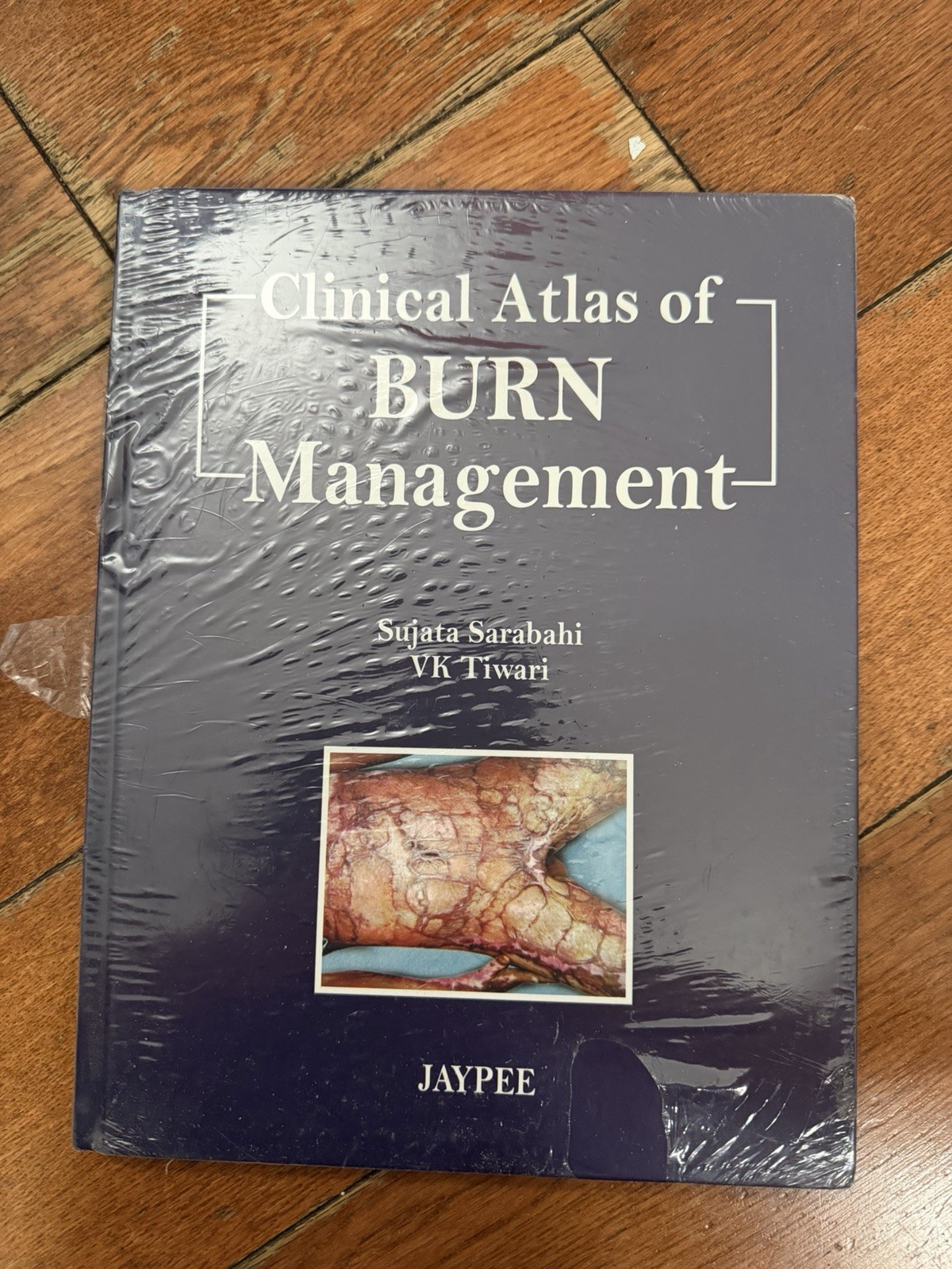 Clinical Atlas of Burn Management by Sujata Sarabahi (Hardcover)