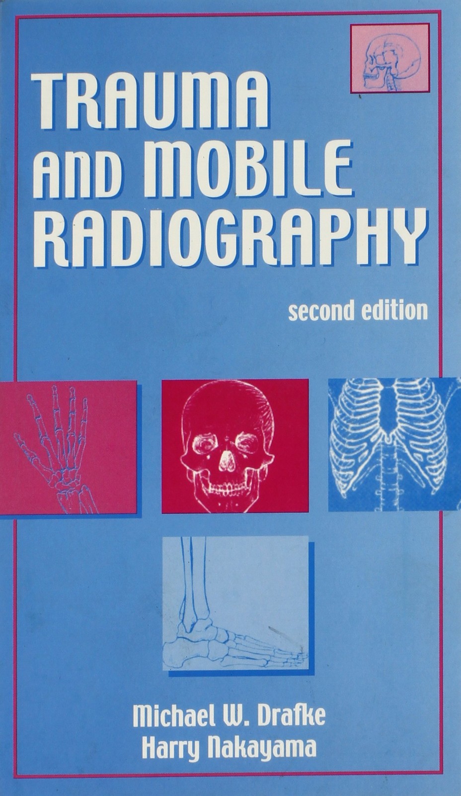 Trauma and Mobile Radiography