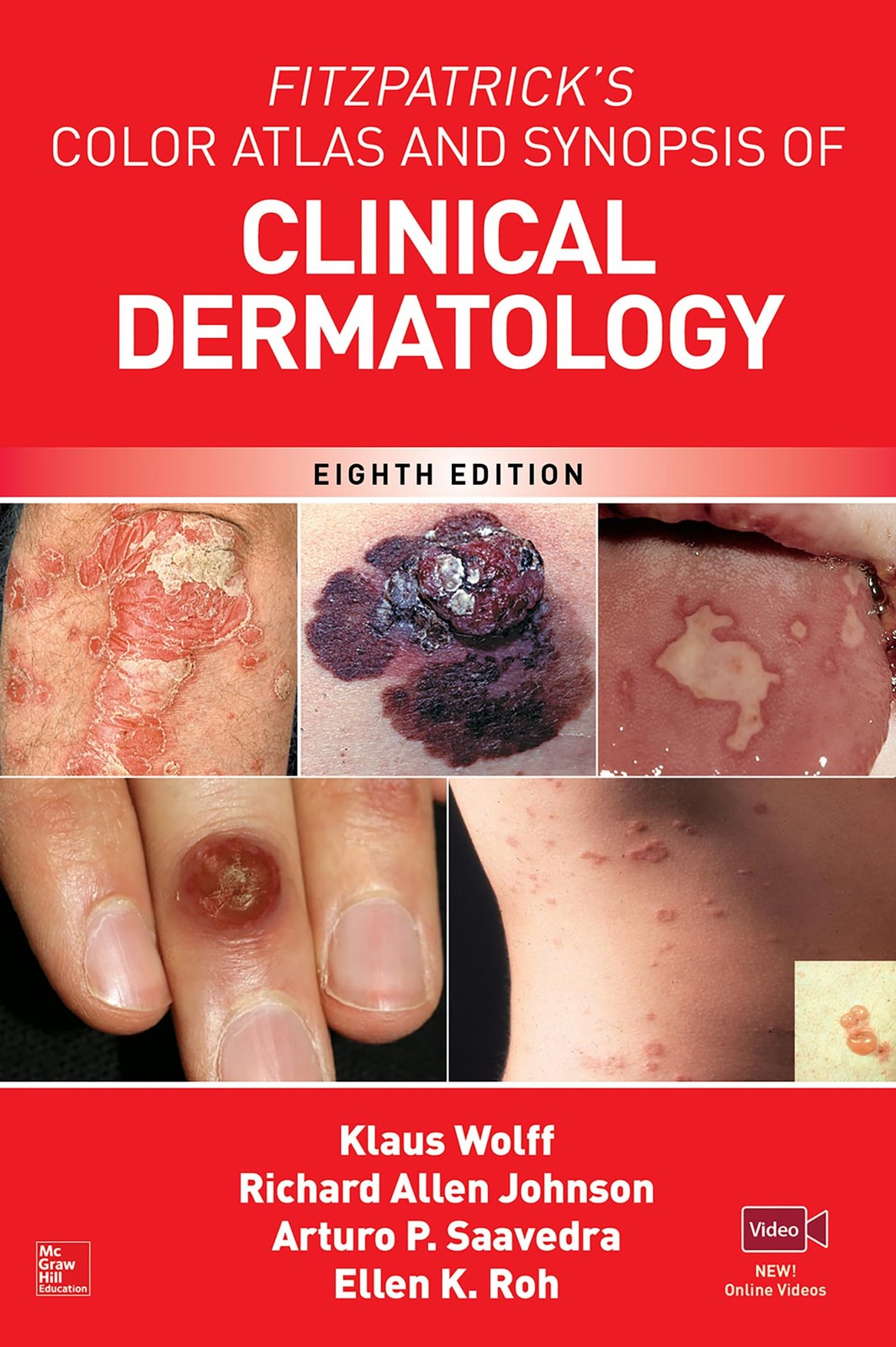 Fitzpatrick’s Color Atlas AND SYNOPSIS OF CLINICAL DERMATOLOGY, 8th Ed
