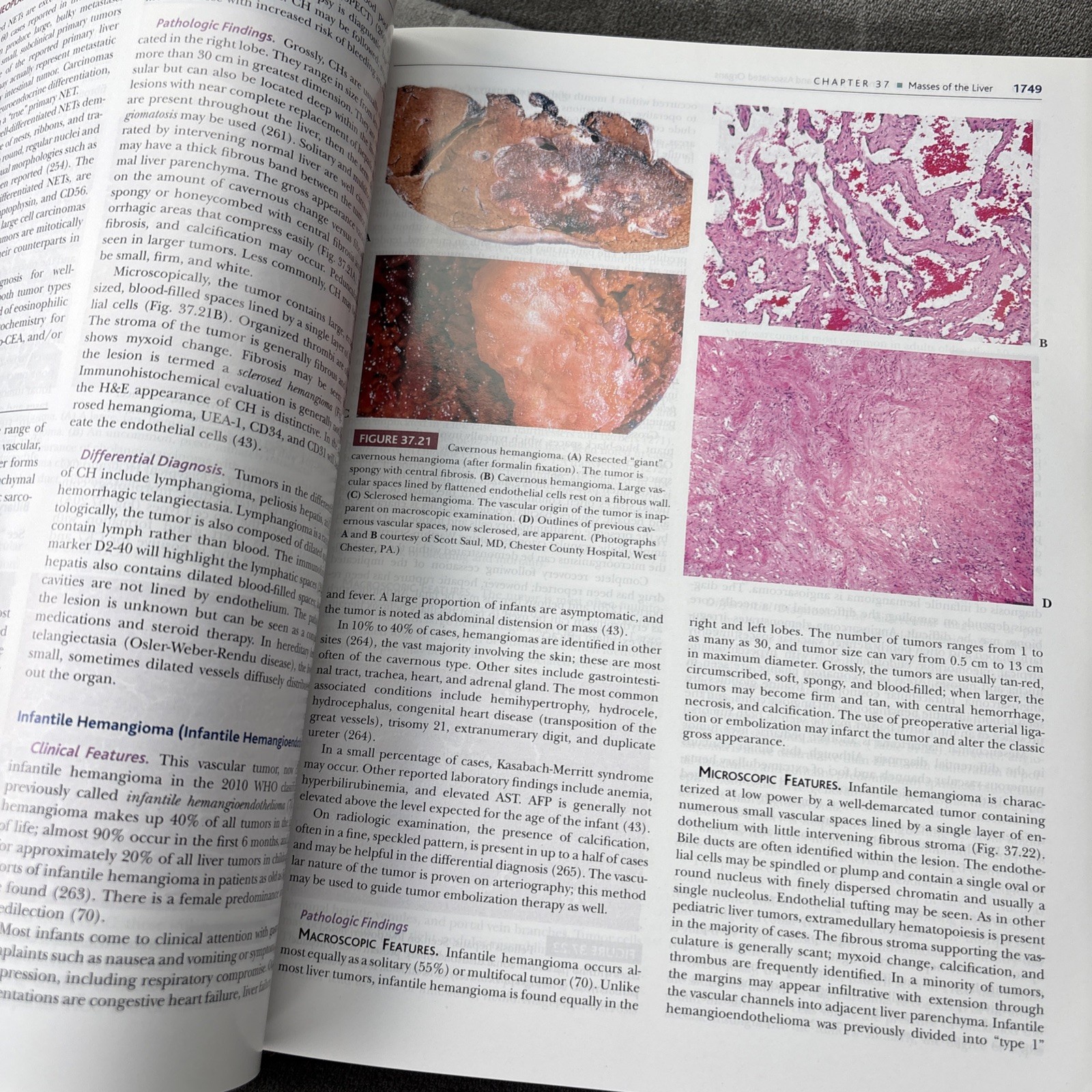 Sternberg’s Diagnostic Surgical Pathology, 2 Volume Set, 6e Like New! Not Used