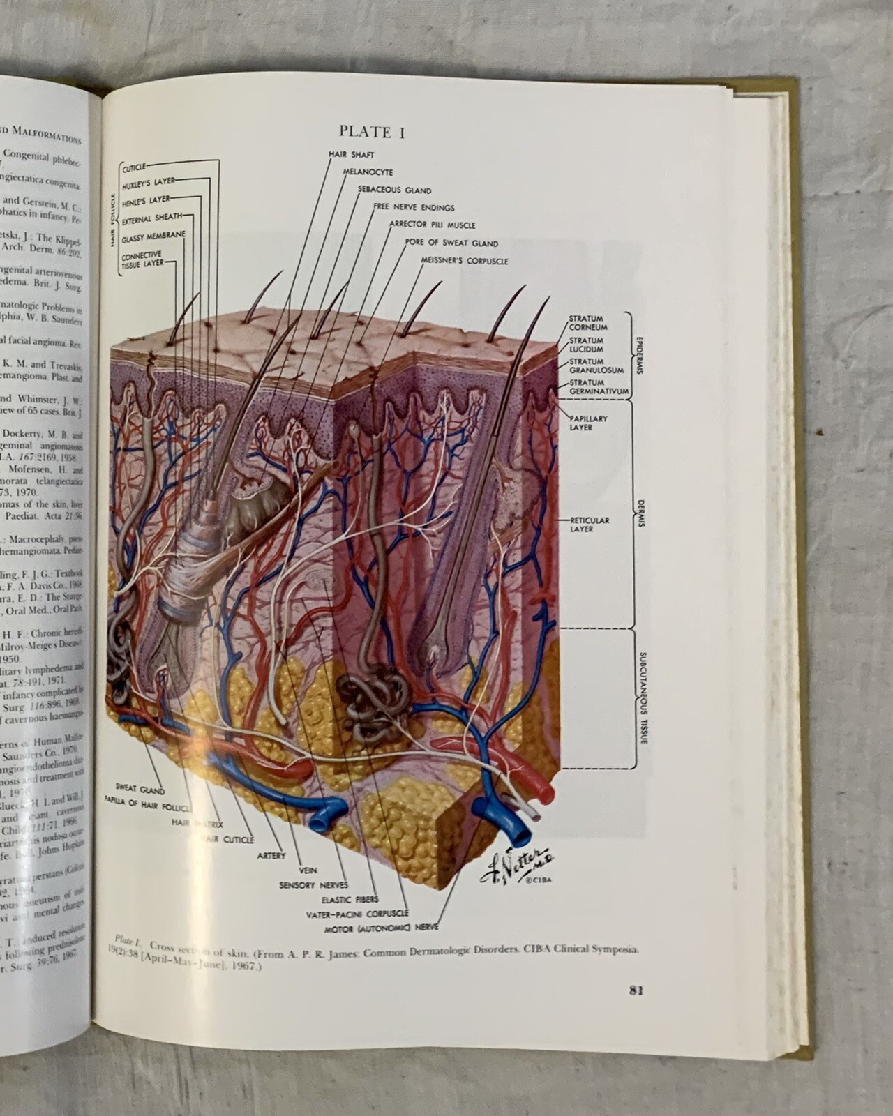 NEONATAL DERMATOLOGY, MAJOR PROBLEMS IN CLINICAL PEDIATRICS by Solomon & Esterly