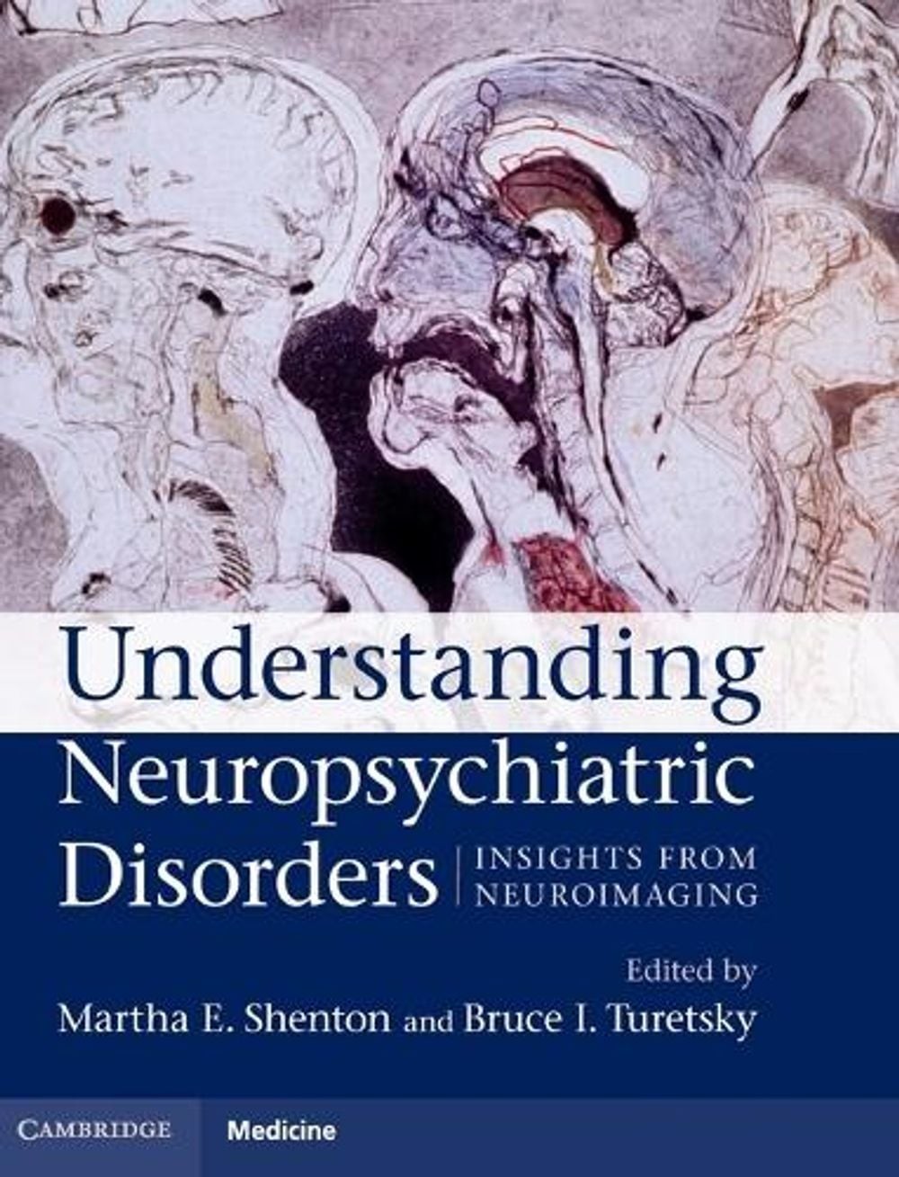Understanding Neuropsychiatric Disorders: Insights from Neuroimaging by Martha E