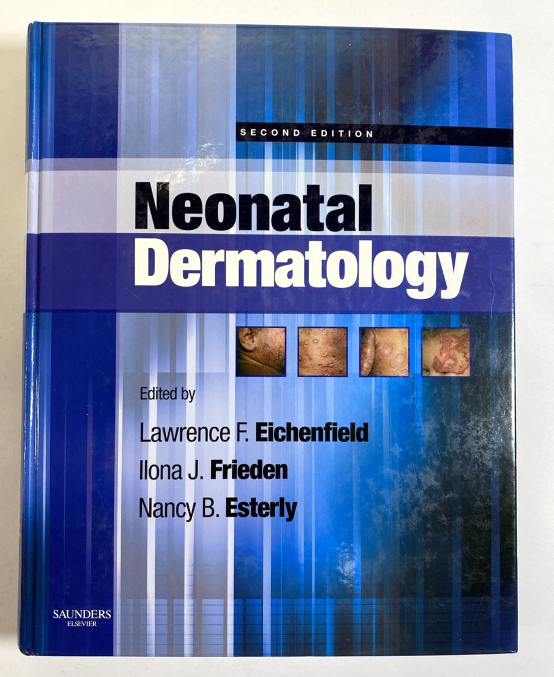 Neonatal Dermatology 2nd ed- Hardcover book – Eichenfield, Frieden, Esterly