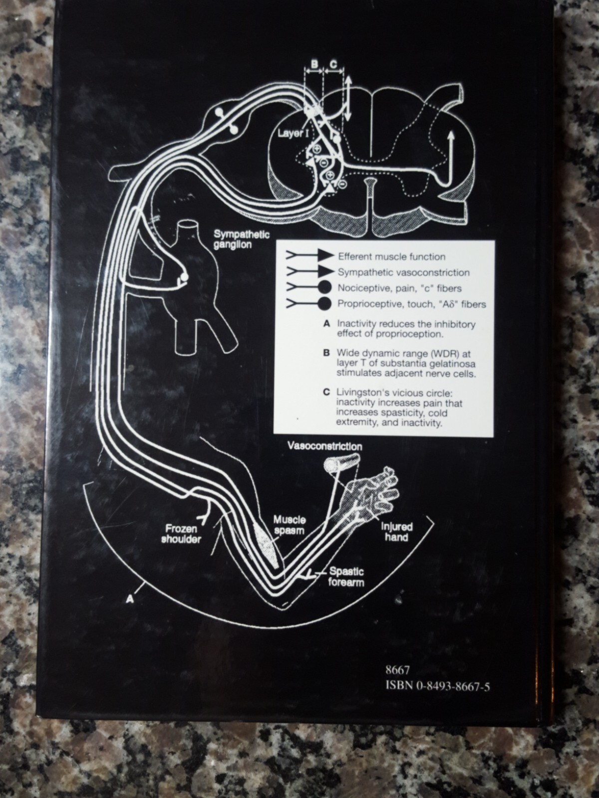 Chronic Pain: Reflex Sympathetic Dystrophy, Prevention, and Management by Hoosha
