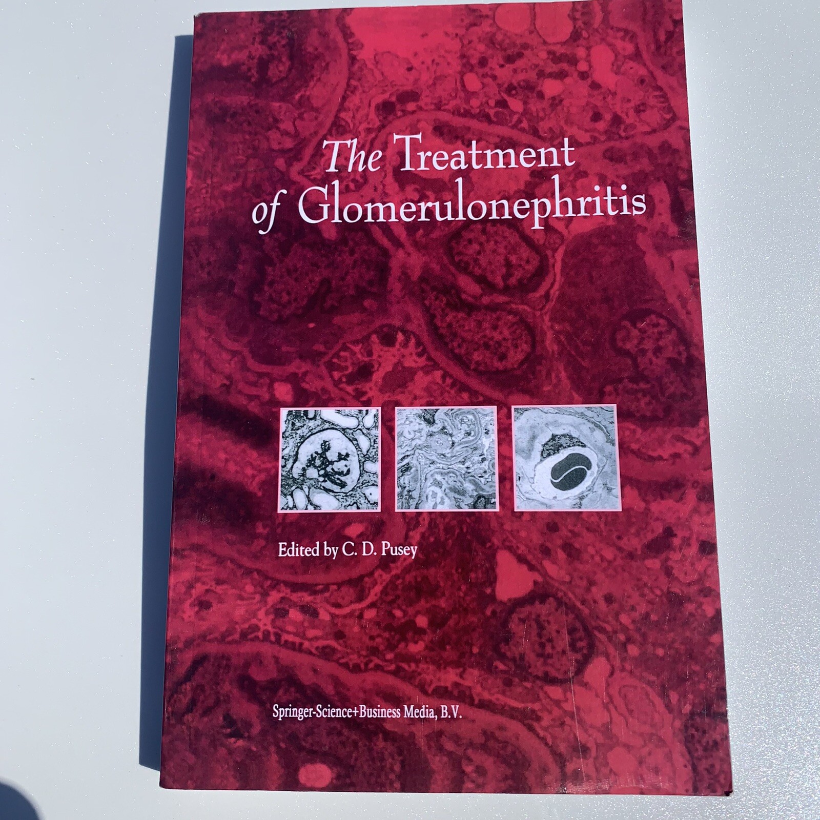 The Treatment of Glomerulonephritis Developments in Nephrology- Springer Pusey