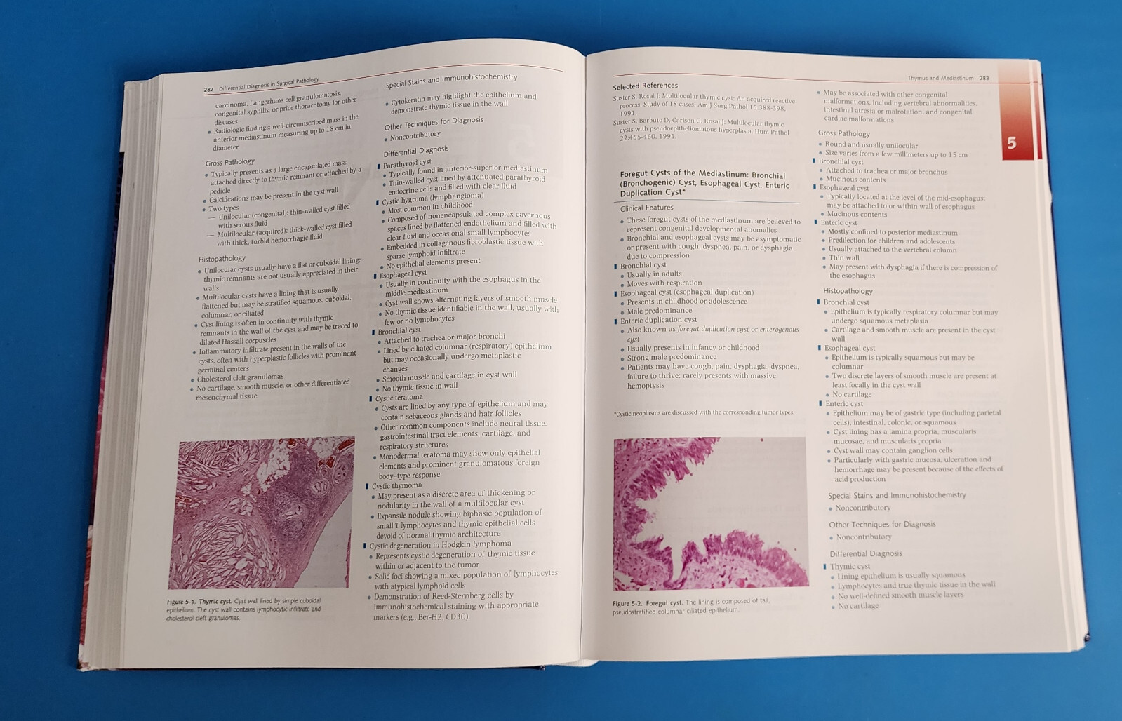 Differential Diagnosis in Surgical Pathology – Expert Consult – 9781416045809