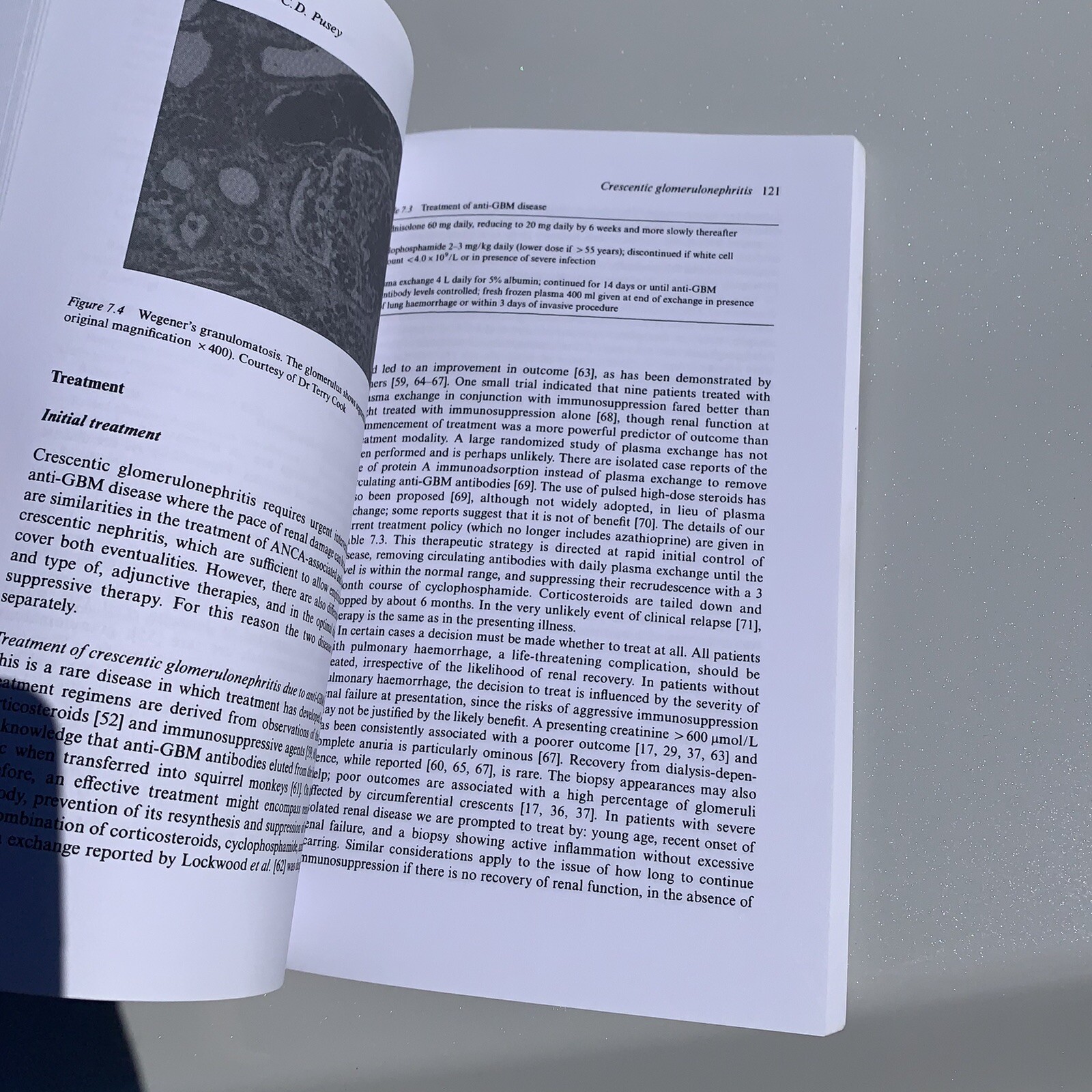The Treatment of Glomerulonephritis Developments in Nephrology- Springer Pusey