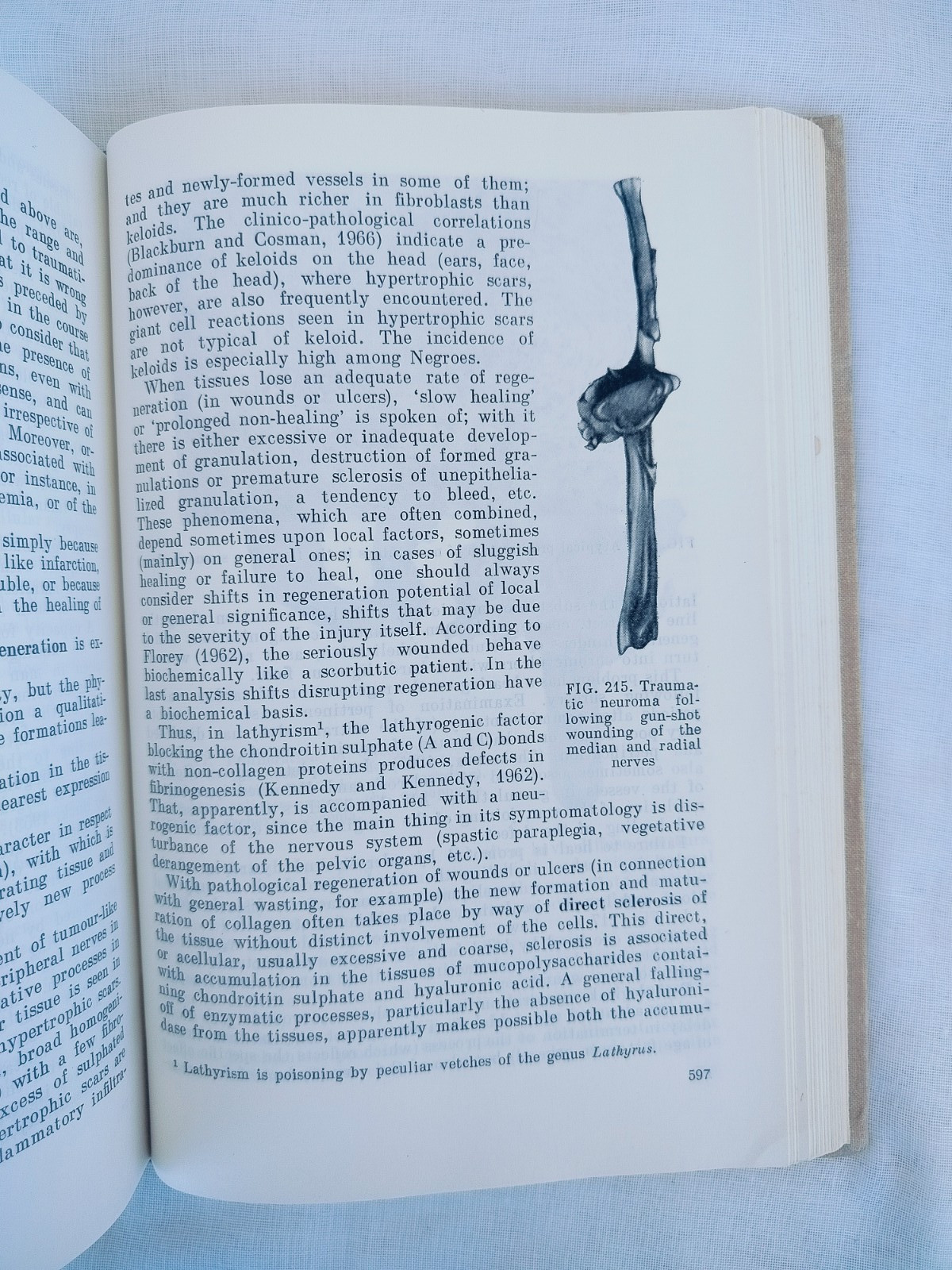 General Human Pathology by Ippolit Davydovsky, Mir Publishers, 1971, Hardcover