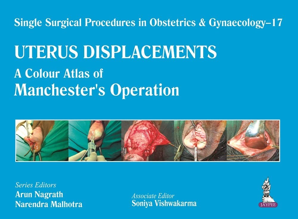 Uterus Displacements: A Colour Atlas of Manchester’s Operation (