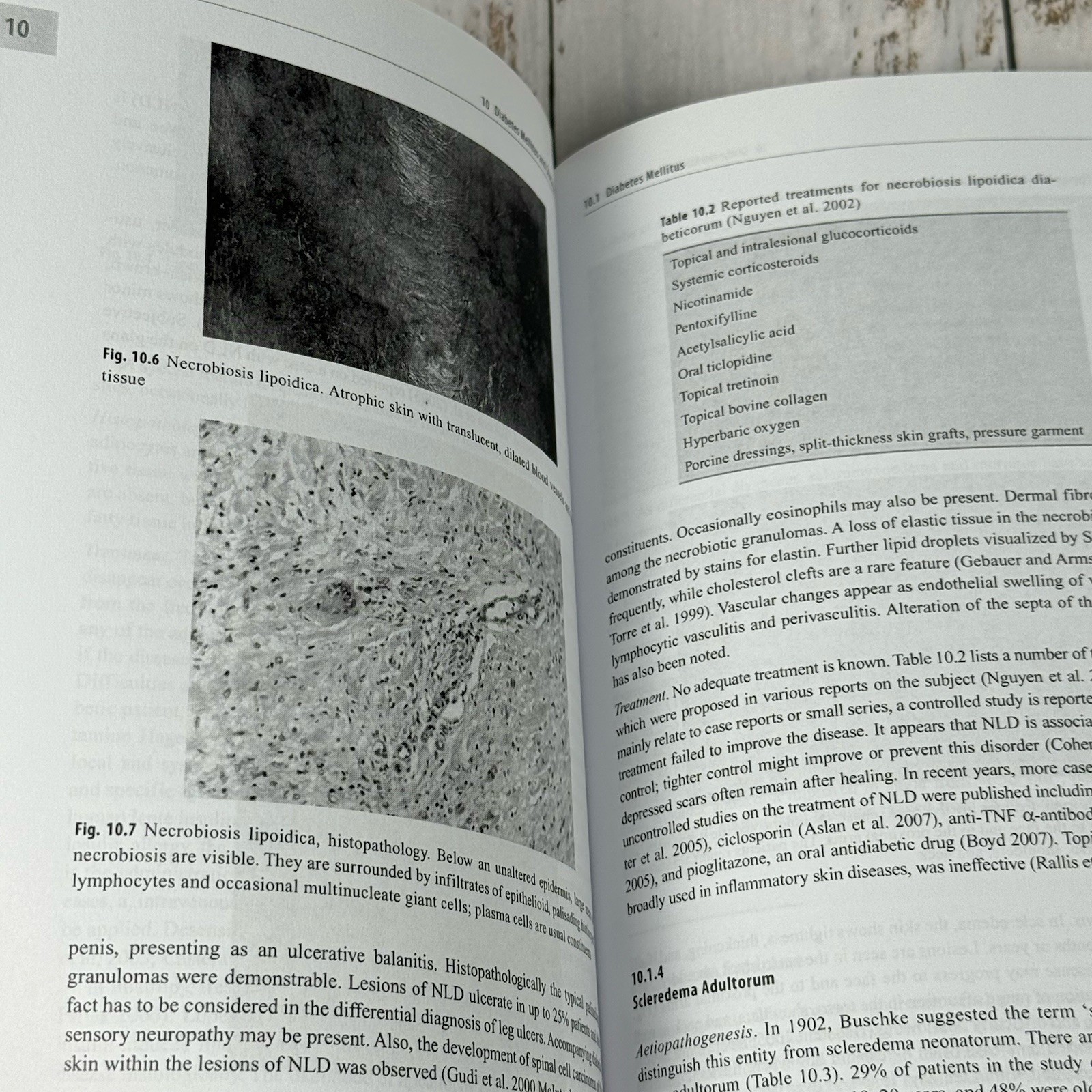 Cutaneous Manifestations of Endocrine Diseases by Walter K.H. Krause PB 2010