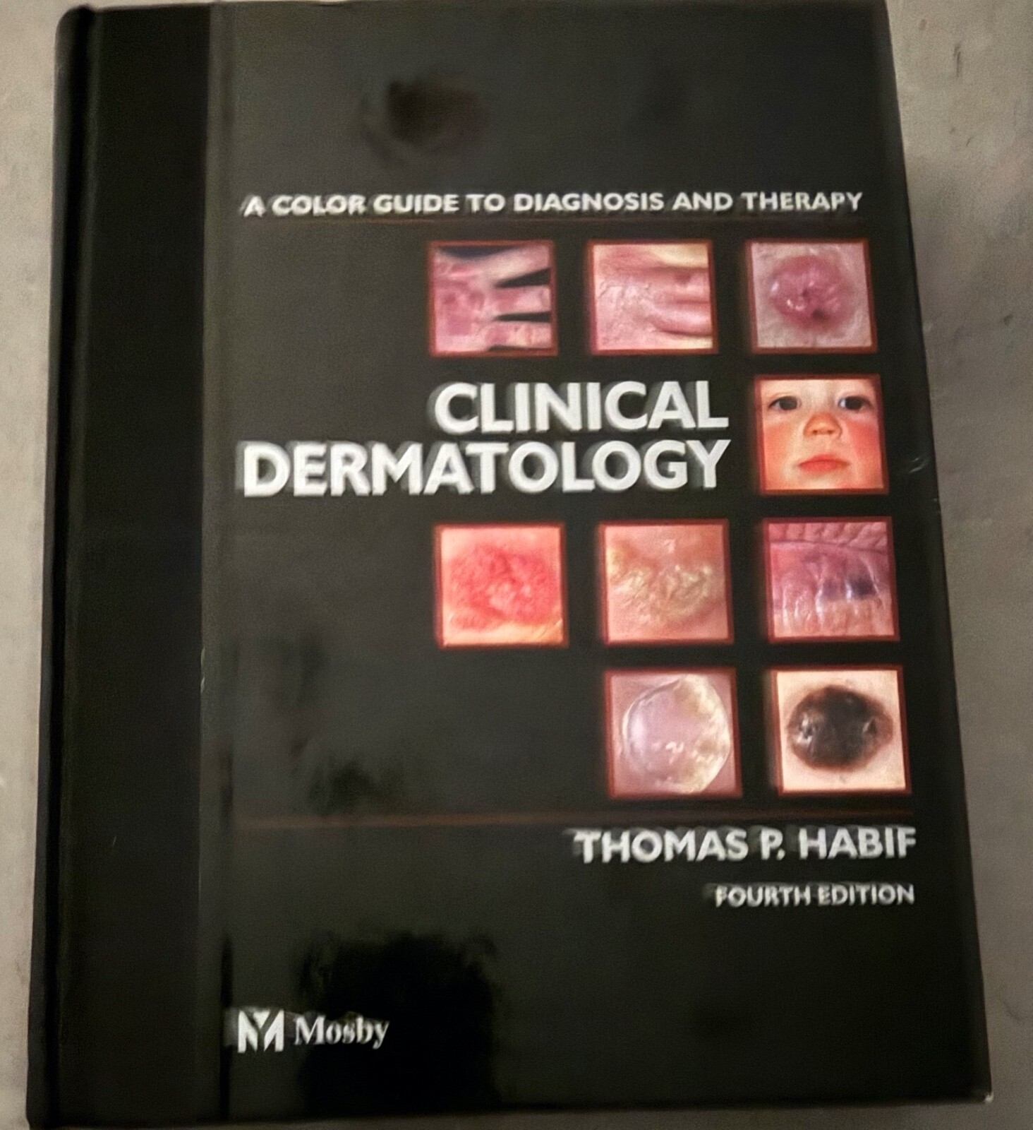 Hard cover illustrated clinical dermatology book 4th edition, author: Habif