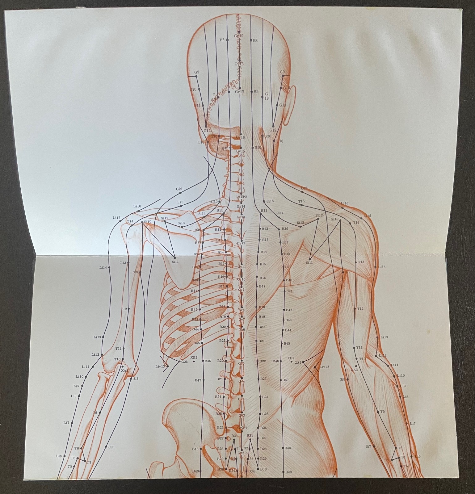 ATLAS OF ACUPUNCTURE. Felix Mann. Heinemann. 1977. Hardback. Good Condition