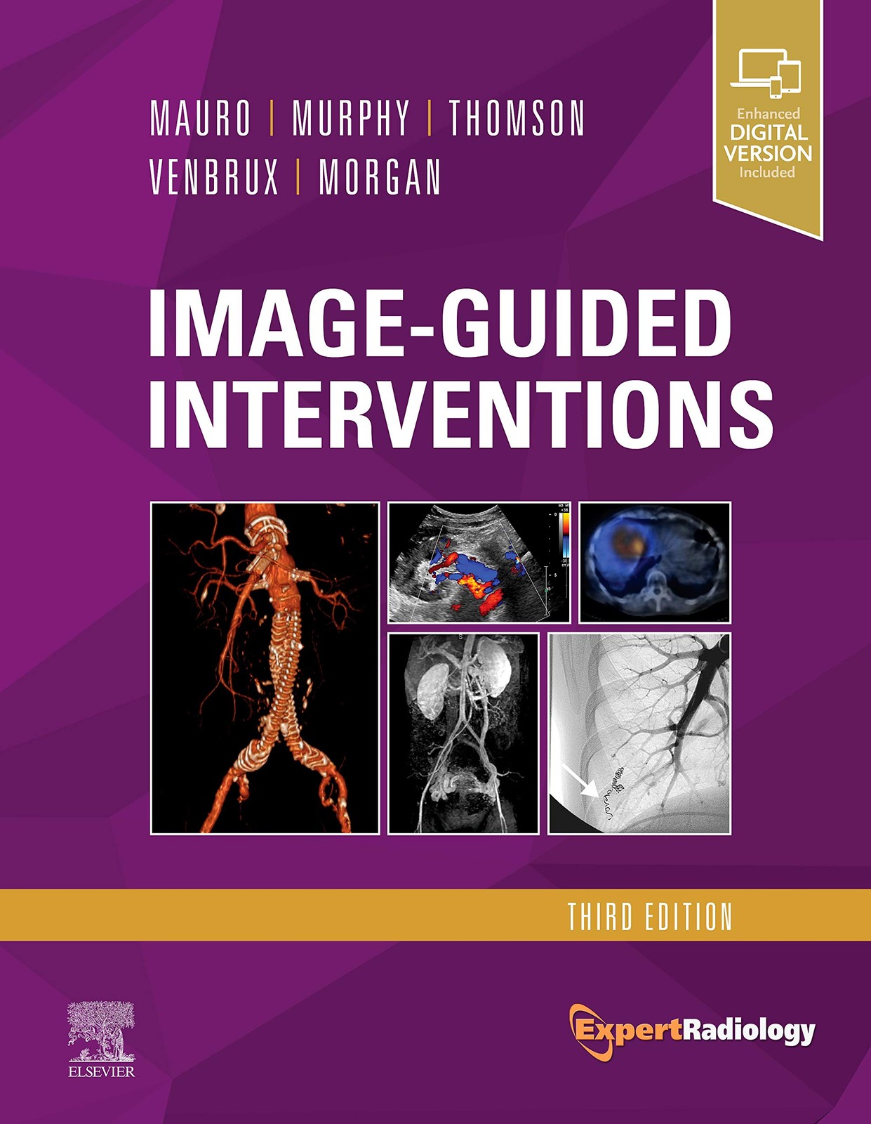 Image-Guided Interventions by Mauro