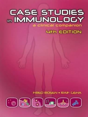 Case Studies in Immunology – VERY GOOD