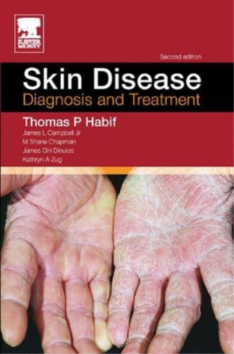 Skin Disease,: Diagnosis and Treatment, Thomas P. Habif, Used; Very Good Book