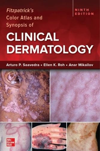 Fitzpatrick’s Color Atlas and Synopsis of Clinical Dermatology, Ninth Edition