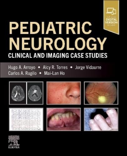 Hugo A. Arroyo Alcy R. Torres Jorge Vidaurre Carlos Pediatric Neuro (Paperback)